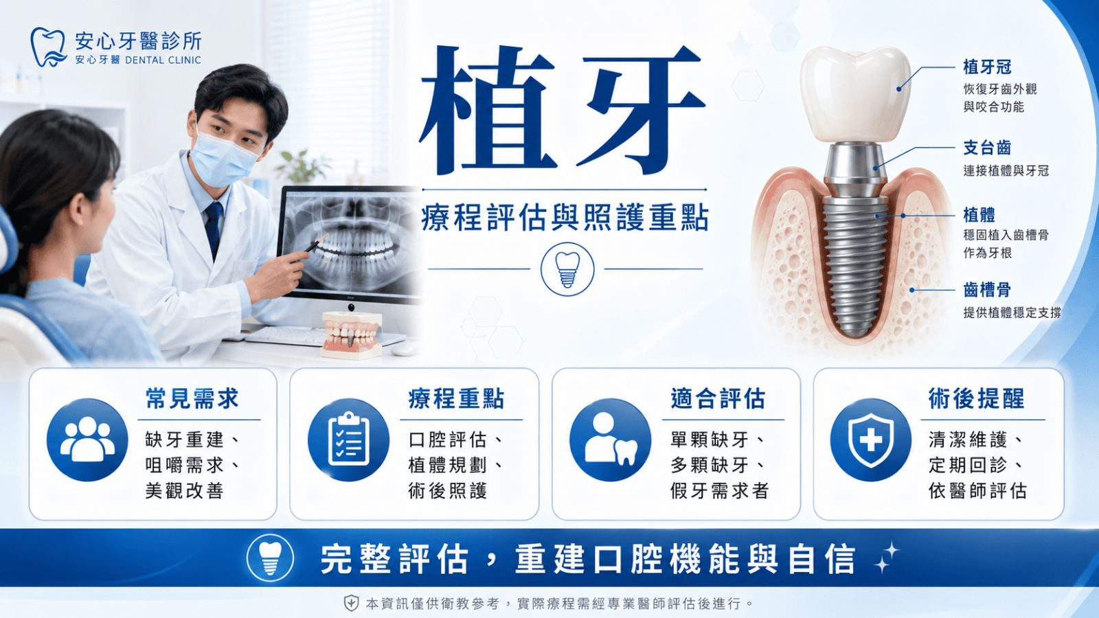 植牙是缺牙重建中常見的治療選項之一